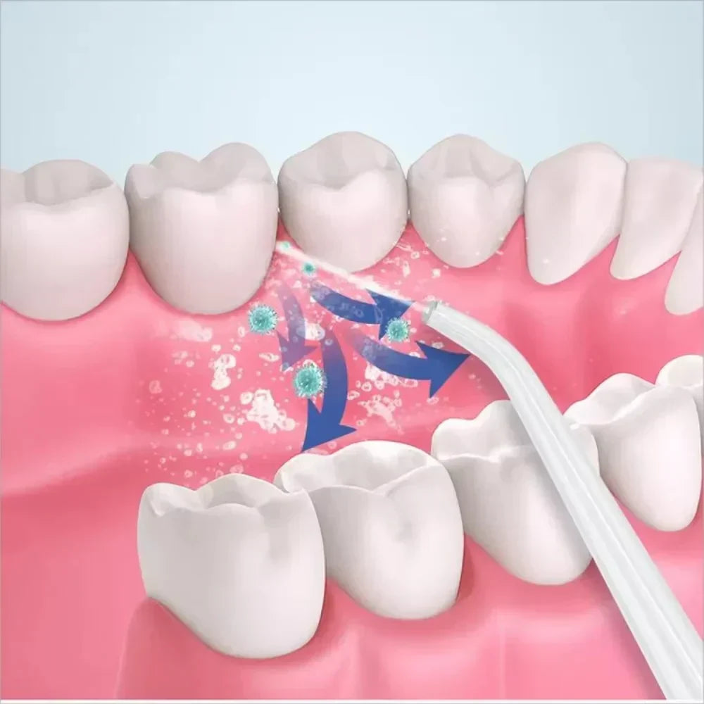 Maiross International™3 In 1 Oral Irrigatorجهاز ري الفم 3 في 1